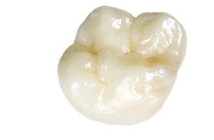 Full Zirconia